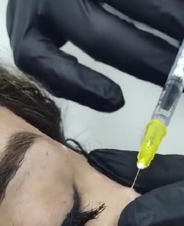 Dermopigmentación
